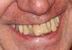dents01.jpg
